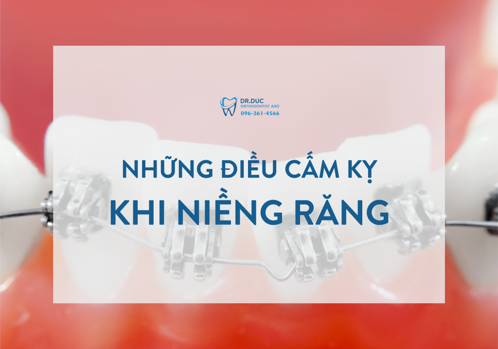Những điều cấm kỵ khi niềng răng 1