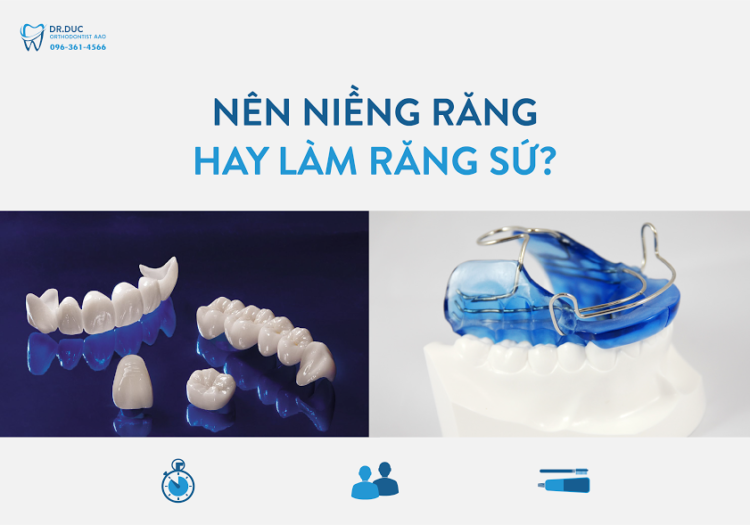 So sánh biện pháp niềng răng và bọc răng sứ 1 So sánh biện pháp niềng răng và bọc răng sứ 1