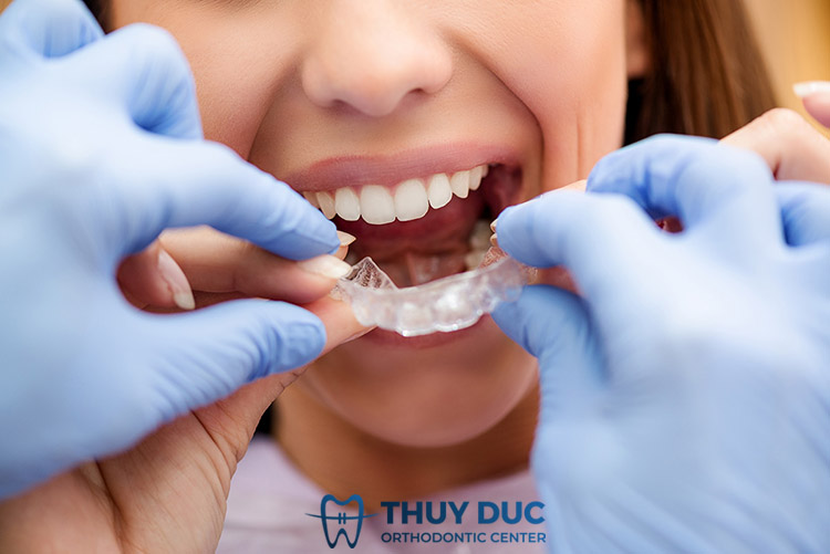Chọn địa chỉ nha khoa niềng răng Invisalign uy tín như thế nào? 1 Chọn địa chỉ nha khoa niềng răng Invisalign uy tín như thế nào? 1