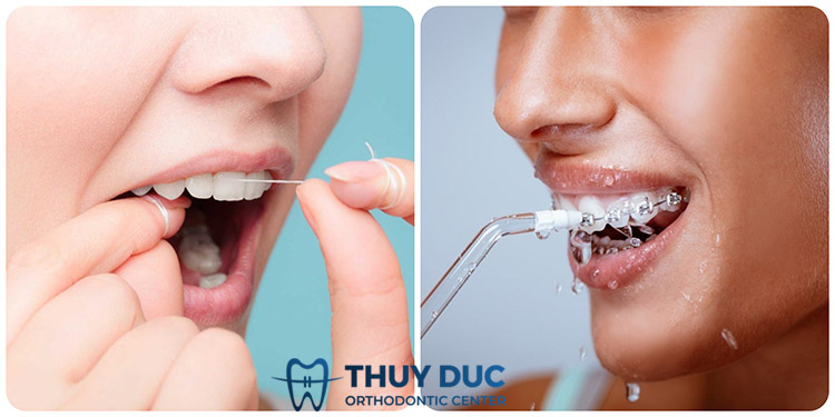 Phương pháp sử dụng 1