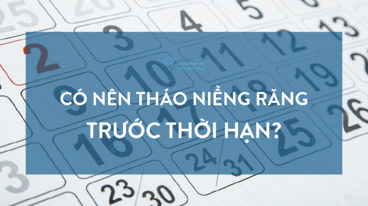 Có nên tháo niềng răng trước thời hạn? 1 Có nên tháo niềng răng trước thời hạn? 1