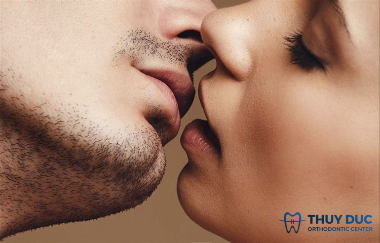 Đeo niềng răng có được hôn không? 1
