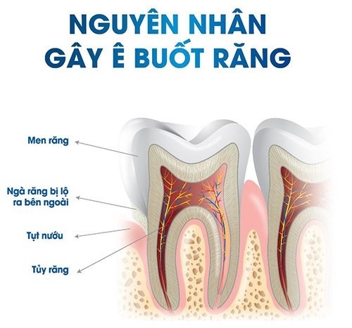 Nền răng yếu 1 Nền răng yếu 1