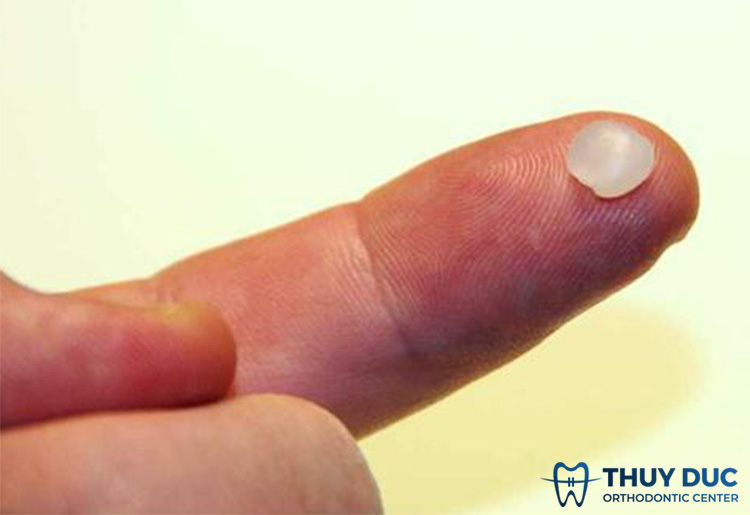 Bước 4: Tiến hành lấy sáp chỉnh nha 1 Bước 4: Tiến hành lấy sáp chỉnh nha 1