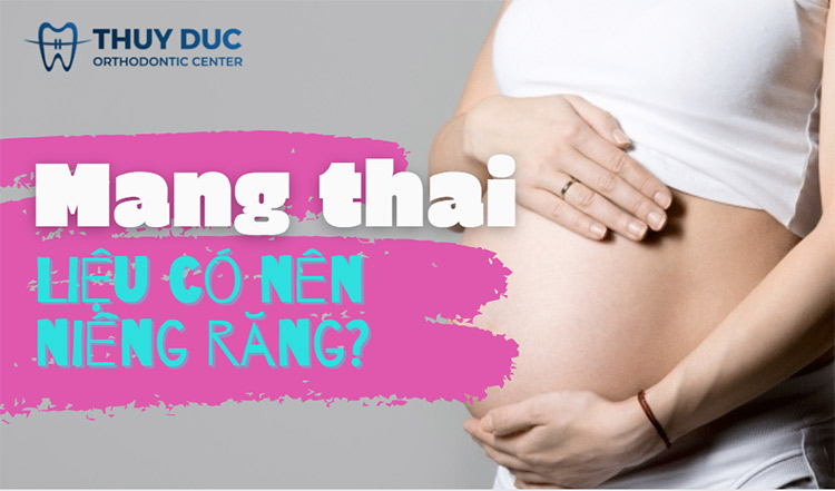 Có nên niềng răng khi mang thai? 1 Có nên niềng răng khi mang thai? 1