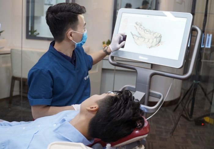 Niềng răng hô nhẹ ở đâu tốt? 1 Niềng răng hô nhẹ ở đâu tốt? 1