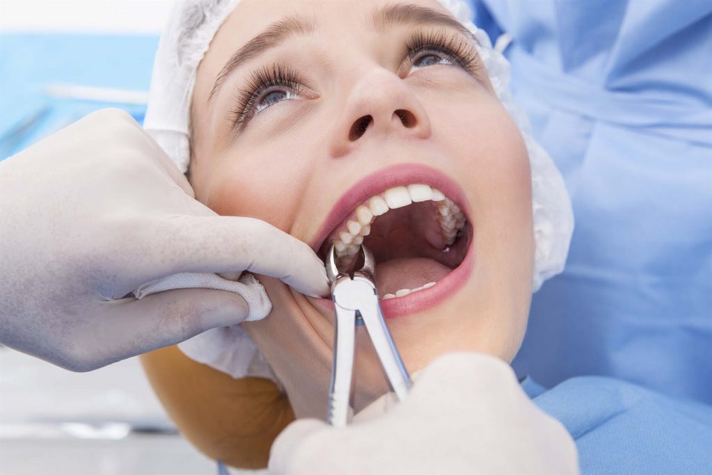 Nhổ răng để niềng răng có đau không? 1 Nhổ răng để niềng răng có đau không? 1
