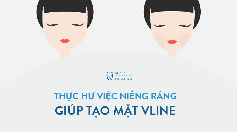 Hóp má do thiếu dinh dưỡng ăn, kiêng nhiều khi niềng răng 1 Hóp má do thiếu dinh dưỡng ăn, kiêng nhiều khi niềng răng 1