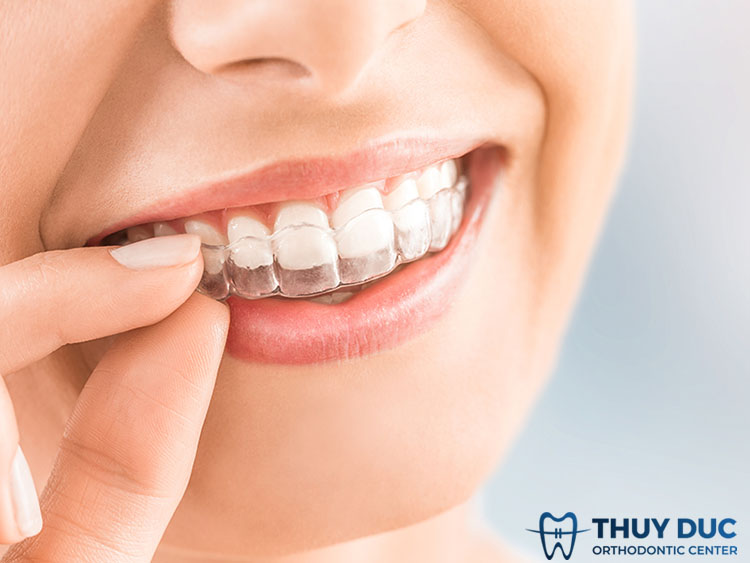 Phương pháp điều trị khớp cắn hở 3