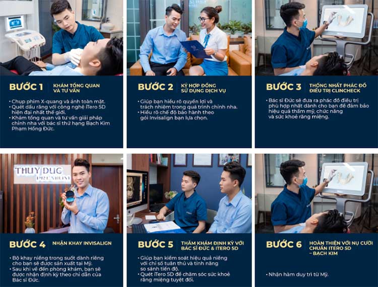 Quy trình niềng răng trong suốt chuẩn Y khoa 1 Quy trình niềng răng trong suốt chuẩn Y khoa 1
