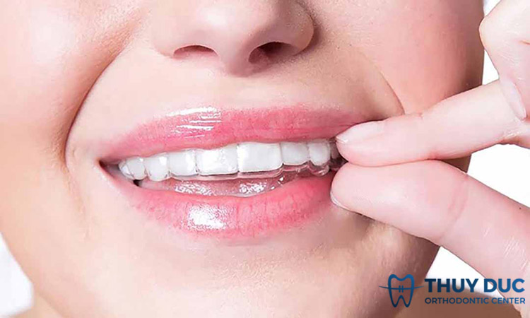 Tính thẩm mỹ cao nhất 1 Tính thẩm mỹ cao nhất 1