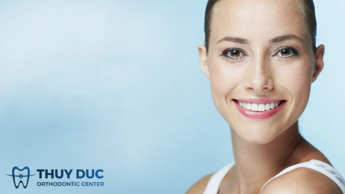 Phương pháp niềng răng 2 Phương pháp niềng răng 2