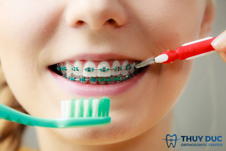 Bước 3: Vệ sinh răng miệng trước khi dùng sáp 1 Bước 3: Vệ sinh răng miệng trước khi dùng sáp 1