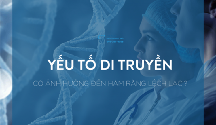 Giải đáp răng lệch lạc có do yếu tố di truyền? 1