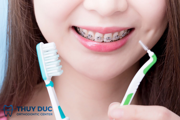 Bàn chải Kin Orthodontics giúp loại bỏ mảnh vụn thức ăn trong rọ hàm không?
