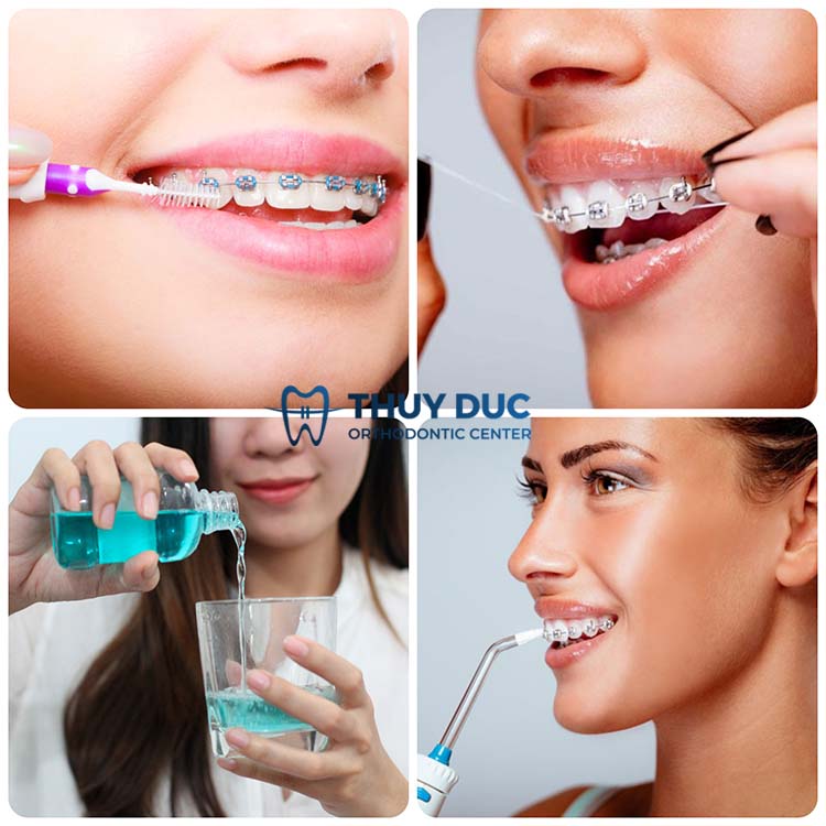 Chăm sóc răng miệng đúng cách 1 Chăm sóc răng miệng đúng cách 1