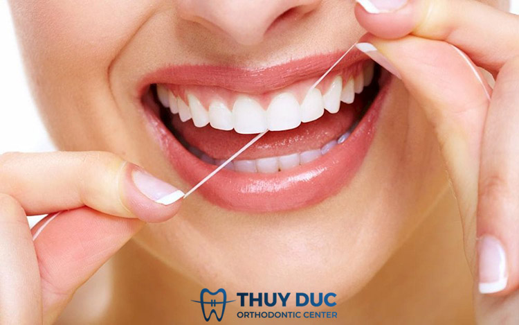 Chỉ nha khoa 1 Chỉ nha khoa 1