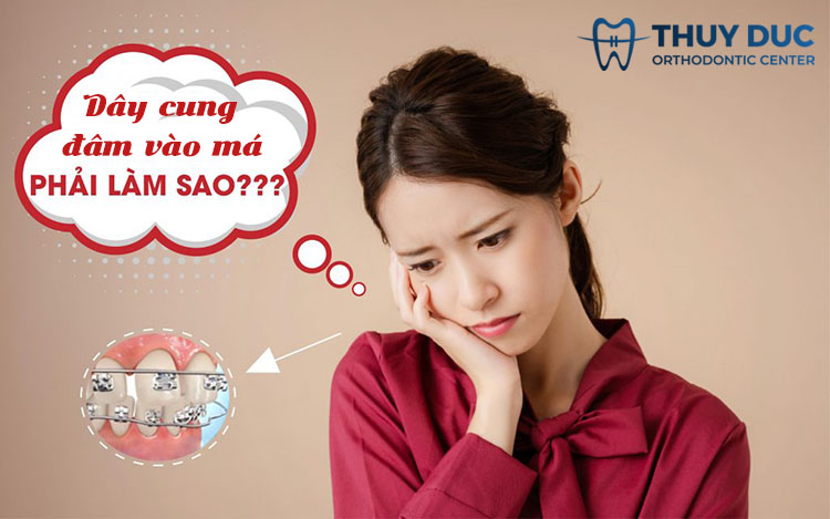 Dây cung đâm vào má có nguy hiểm không? 1 Dây cung đâm vào má có nguy hiểm không? 1