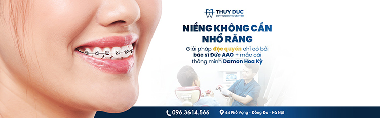 Niềng không nhổ răng F.A.C.E tại Nha khoa Thúy Đức 1 Niềng không nhổ răng F.A.C.E tại Nha khoa Thúy Đức 1