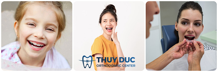 Niềng răng bao lâu phụ thuộc vào độ tuổi thực hiện 1 Niềng răng bao lâu phụ thuộc vào độ tuổi thực hiện 1