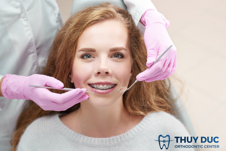Niềng răng bao lâu phụ thuộc vào tình trạng răng 1 Niềng răng bao lâu phụ thuộc vào tình trạng răng 1
