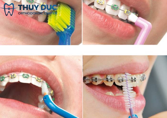 Chăm sóc răng miệng đúng cách 1 Chăm sóc răng miệng đúng cách 1