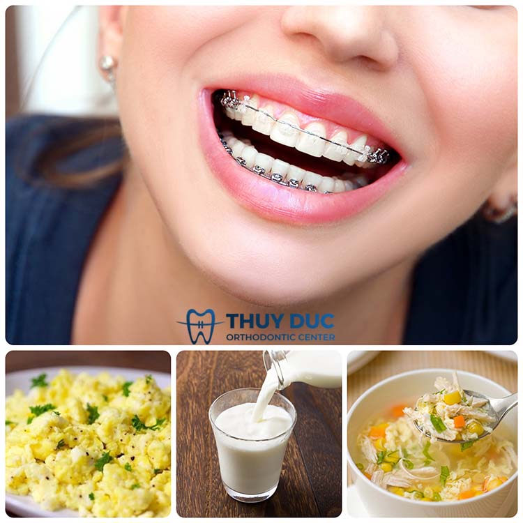 Thói quen ăn uống 1 Thói quen ăn uống 1