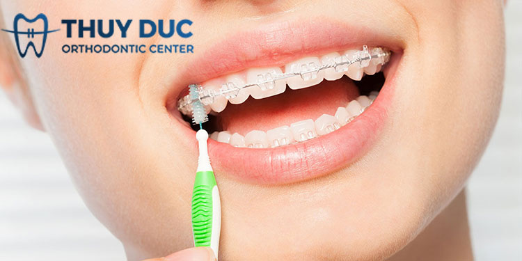 1. Bàn chải kẽ răng 1 1. Bàn chải kẽ răng 1