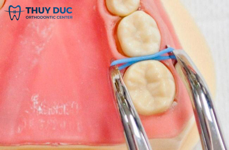 Cách 2: Dùng kìm 1 Cách 2: Dùng kìm 1