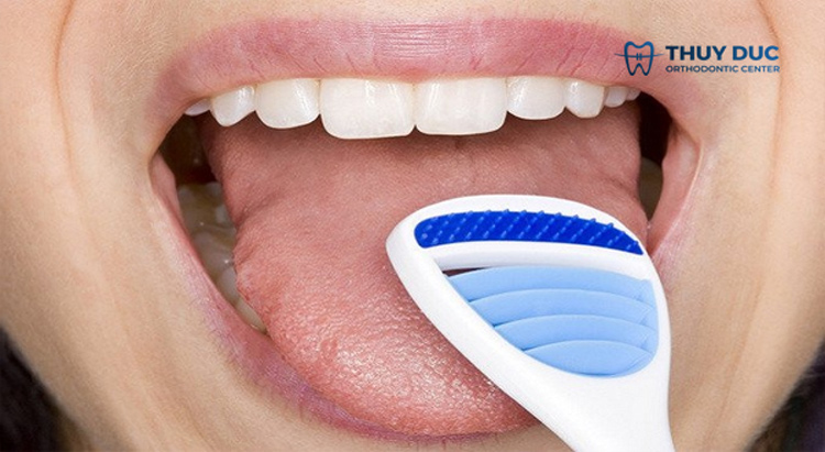 1. Vệ sinh răng miệng sau mỗi bữa ăn và ăn nhẹ để tránh hơi thở có mùi với niềng răng 4