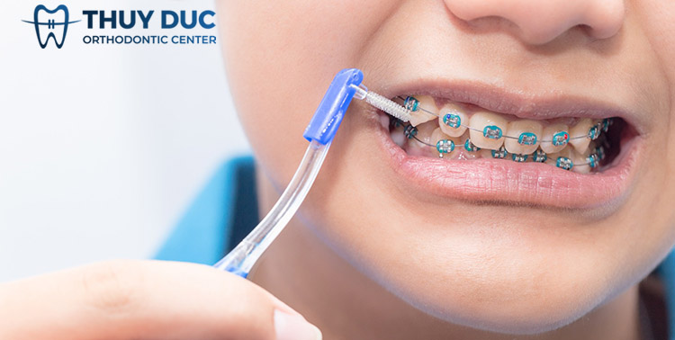 7.1. Chải răng đúng cách 1 7.1. Chải răng đúng cách 1