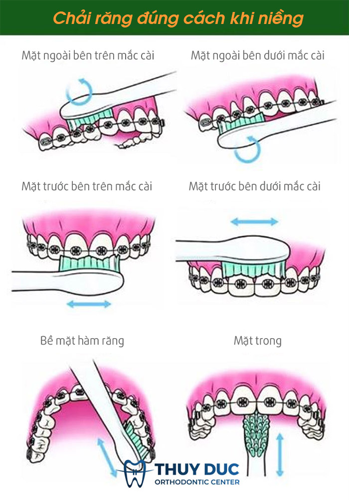 Chải răng và dùng chỉ nha khoa đều đặn và thường xuyên 1 Chải răng và dùng chỉ nha khoa đều đặn và thường xuyên 1