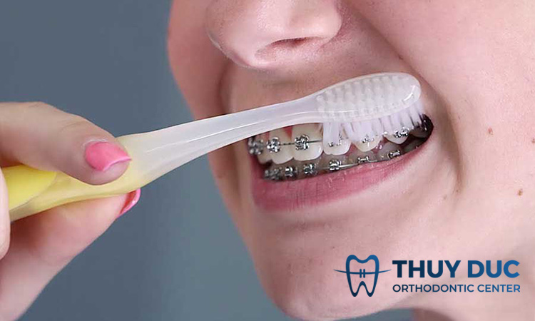 Vệ sinh răng miệng không đúng cách 1 Vệ sinh răng miệng không đúng cách 1