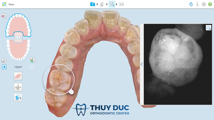 1. Công nghệ NIRI 1 1. Công nghệ NIRI 1