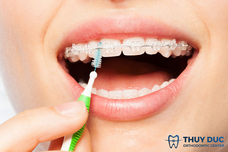 Đánh răng đúng cách 1 Đánh răng đúng cách 1