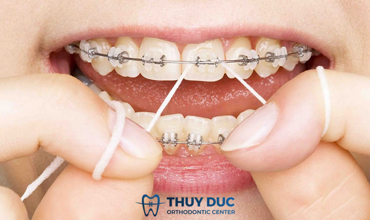 Dùng thêm chỉ nha khoa 1 Dùng thêm chỉ nha khoa 1