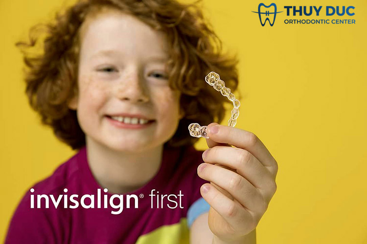 Invisalign First là gì? 1