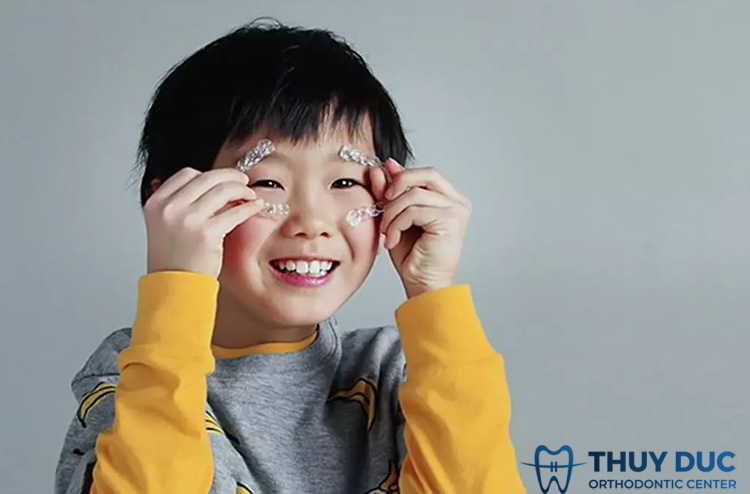 Lợi ích khi niềng răng Invisalign First 1