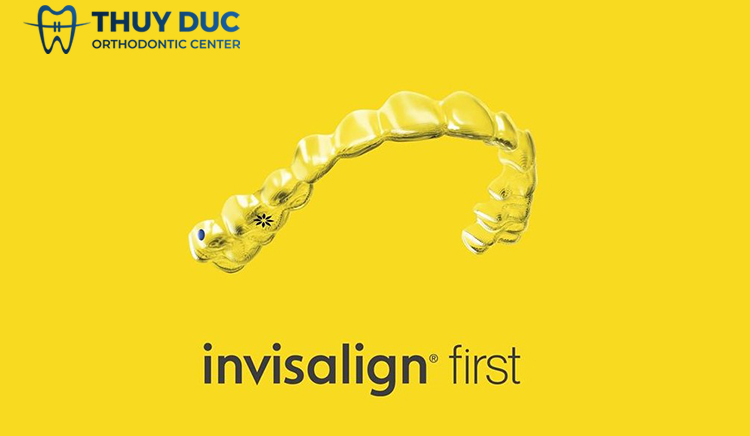 Invisalign First có gì đặc biệt? 1