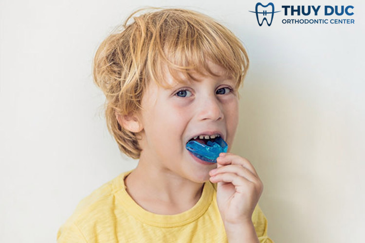 Niềng răng cho trẻ bằng khí cụ tháo lắp 1 Niềng răng cho trẻ bằng khí cụ tháo lắp 1