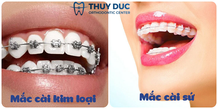 Tính thẩm mỹ 1 Tính thẩm mỹ 1