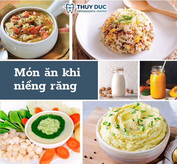 Các thực phẩm nên bổ sung 1 Các thực phẩm nên bổ sung 1