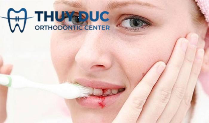 Vệ sinh răng không đúng cách 1 Vệ sinh răng không đúng cách 1