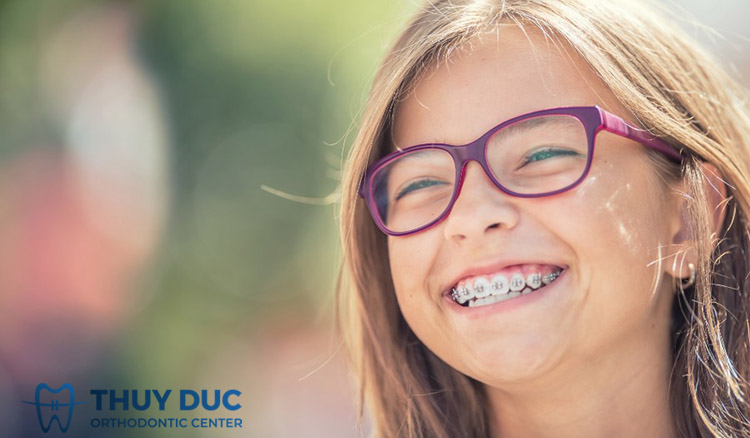 1. Nhận thức đúng về niềng răng sớm cho trẻ 1 1. Nhận thức đúng về niềng răng sớm cho trẻ 1