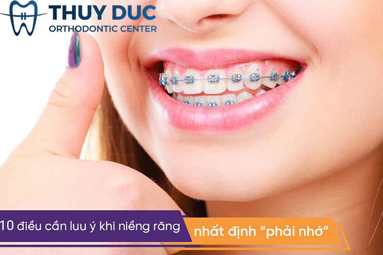 10 Điều Cần Lưu ý Khi Niềng Răng để Có Hàm Răng đẹp Chuẩn Khớp Cắn Bác Sĩ Đức Aao 4419