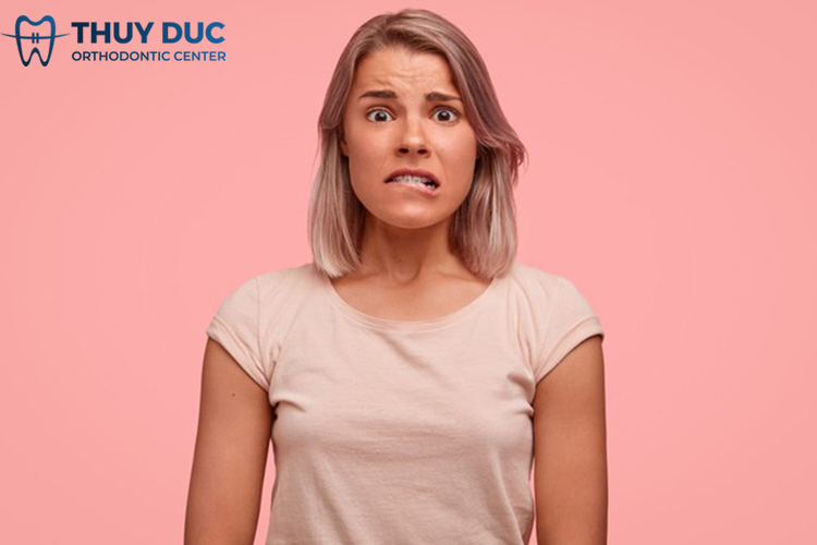 Niềng răng mắc cài kim loại tự đóng (tự buộc) 2 Niềng răng mắc cài kim loại tự đóng (tự buộc) 2