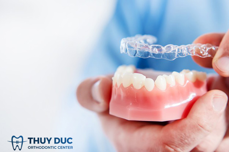 Nhược điểm của niềng răng trong suốt 1