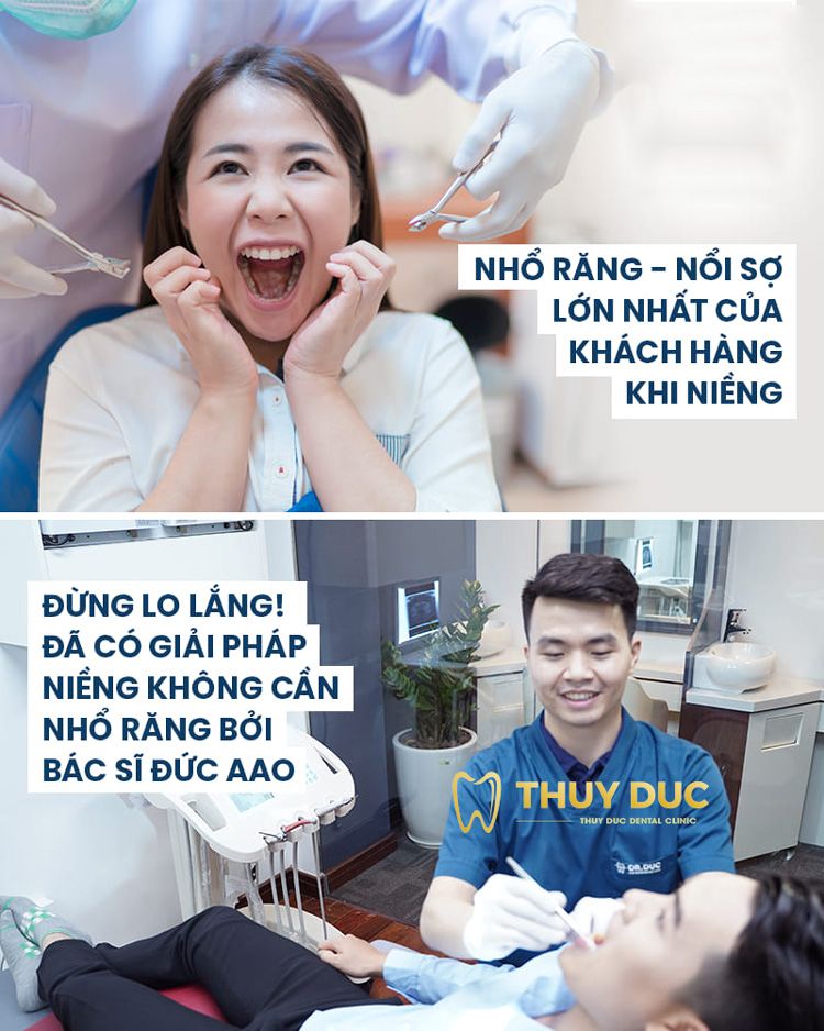 Giới thiệu phương pháp niềng răng không nhổ F.A.C.E tại Nha khoa Thúy Đức 1 Giới thiệu phương pháp niềng răng không nhổ F.A.C.E tại Nha khoa Thúy Đức 1