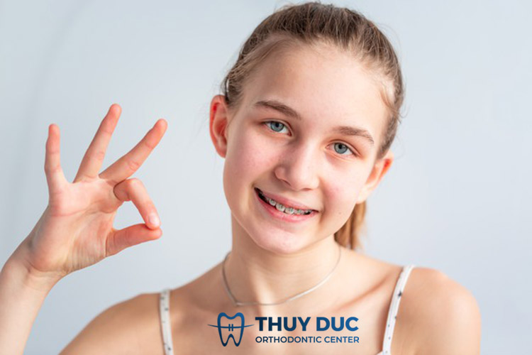 Độ tuổi vàng để niềng răng cho trẻ 1 Độ tuổi vàng để niềng răng cho trẻ 1