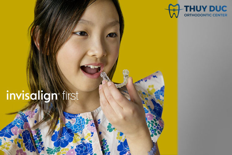 Niềng răng cho trẻ bằng Invisalign First 1